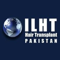 hairtransplant