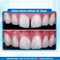 tramrang